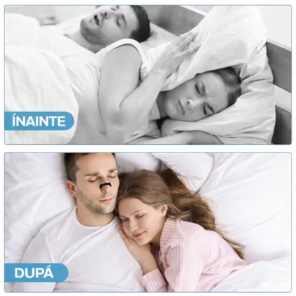 Comparație înainte și după utilizarea dilatatorului nazal, evidențiind reducerea sforăitului și un somn mai liniștit prin îmbunătățirea fluxului de aer.
